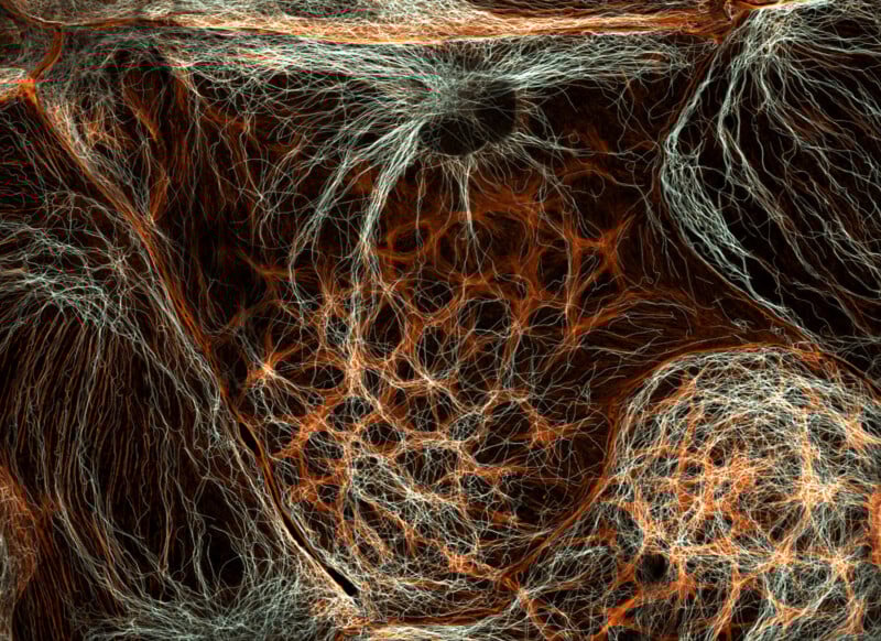 Microscopic view of intricate, web-like networks of orange and white fibers, forming complex, organic patterns against a dark background. The image resembles interconnected cells or neural networks.