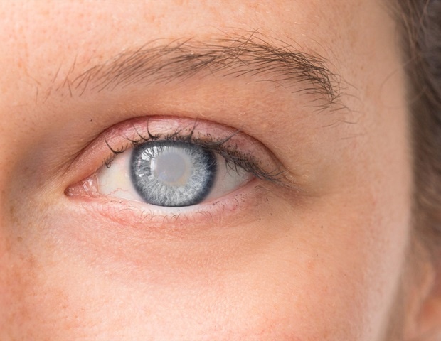 Revolutionizing cataract surgery with office-based oral sedation