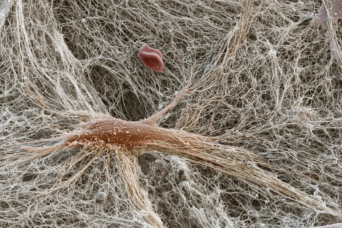 A scanning electron micrograph (SEM) image of fibroblast cells