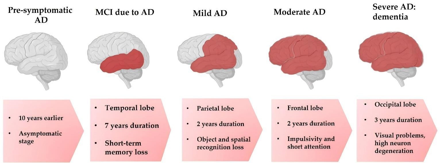 Progressive stages in the development of AD