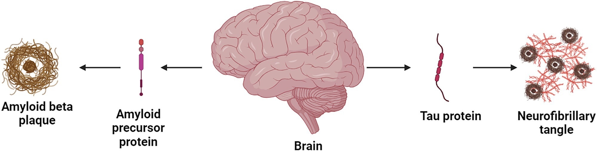 The degenerative cascade in AD.