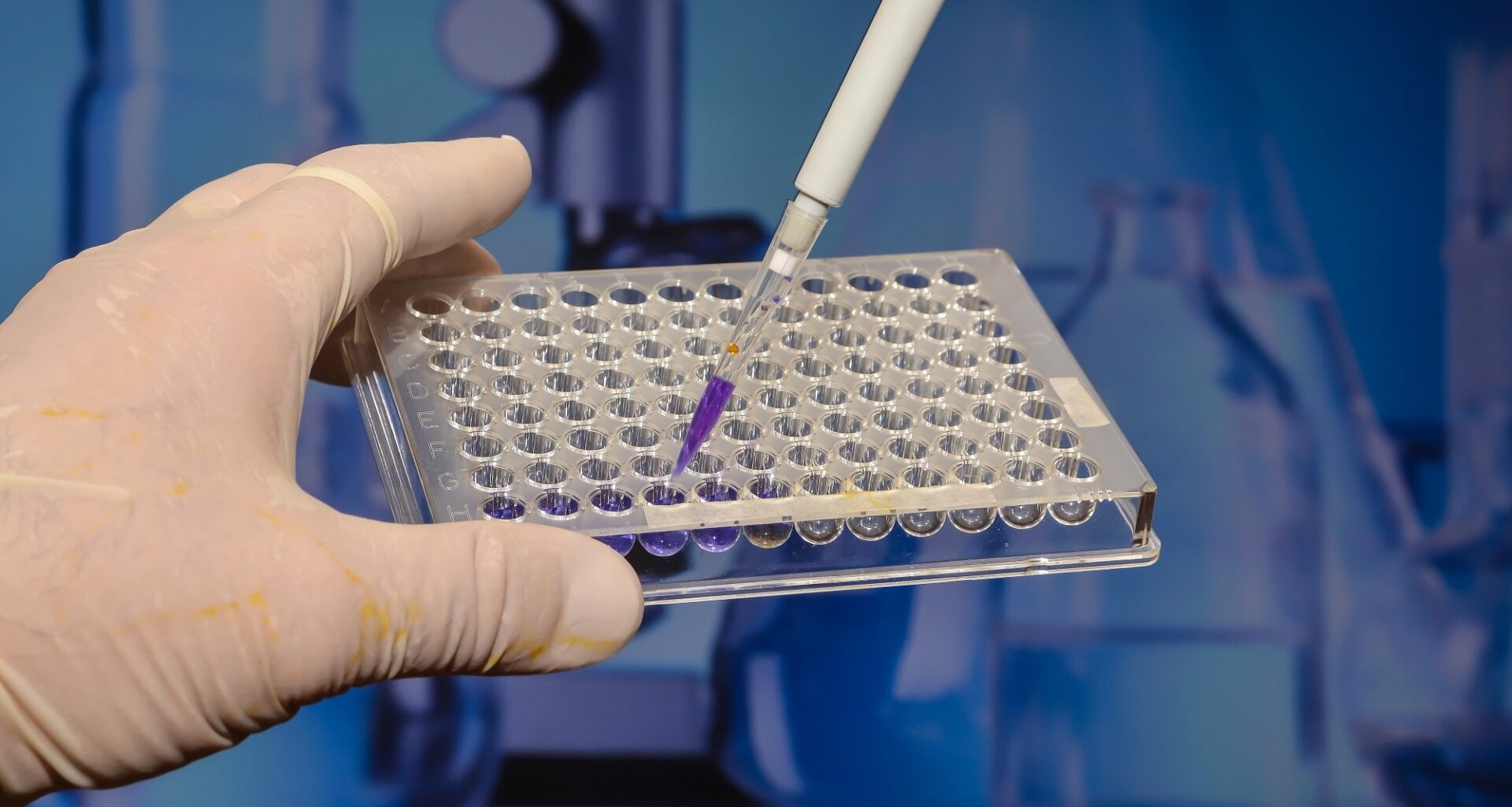 Study: Feasibility, acceptability and clinical outcomes of the BabyScreen+ genomic newborn screening study. Image Credit: Sergei Drozd / Shutterstock