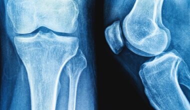 Review: Impact of yogurt consumption on bone health markers in adults with or without osteoporosis: a systematic review and meta-analysis. Image Credit: siamionau pavel / Shutterstock