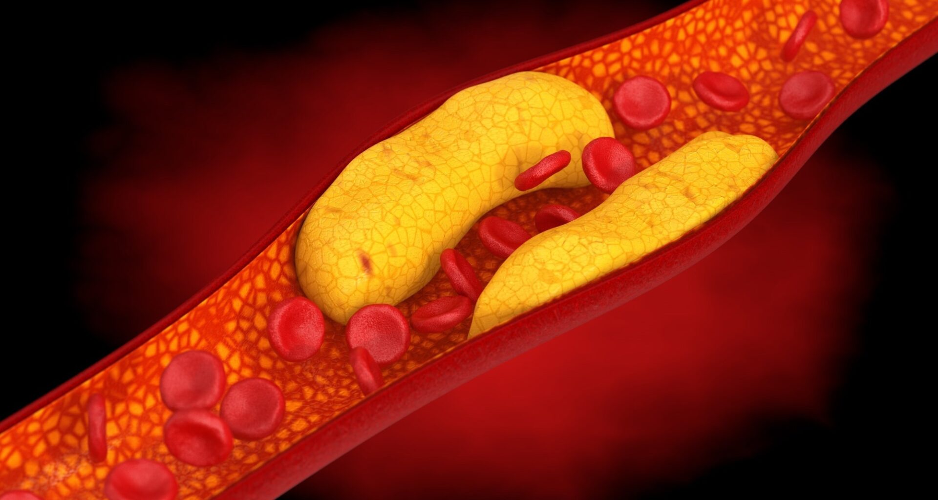 Study: Sex differences in the association of wearable accelerometer-derived physical activity with coronary heart disease incidence and mortality. Image Credit: doomu / Shutterstock