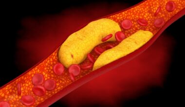 Study: Sex differences in the association of wearable accelerometer-derived physical activity with coronary heart disease incidence and mortality. Image Credit: doomu / Shutterstock