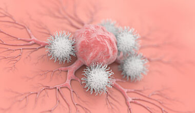 Boosted 'Natural Killer' Cells Could Lead to Off-The-Shelf Cancer Immunotherapy : ScienceAlert