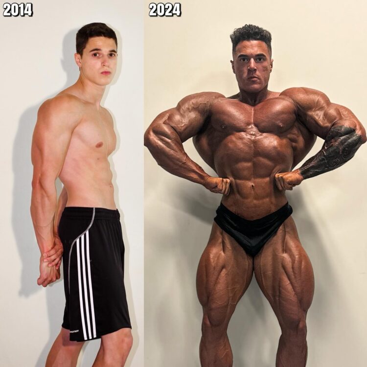 Matt Greggo Transformation Matt Greggo Transformation