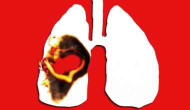 New trick could stop lung cancer in its tracks