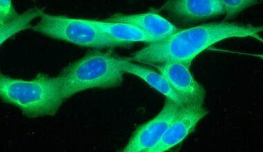CRATERs identified as key sites for T cell-mediated tumor destruction