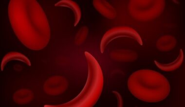 Using placental growth factor to predict preeclampsia risk in pregnant women with sickle cell disease