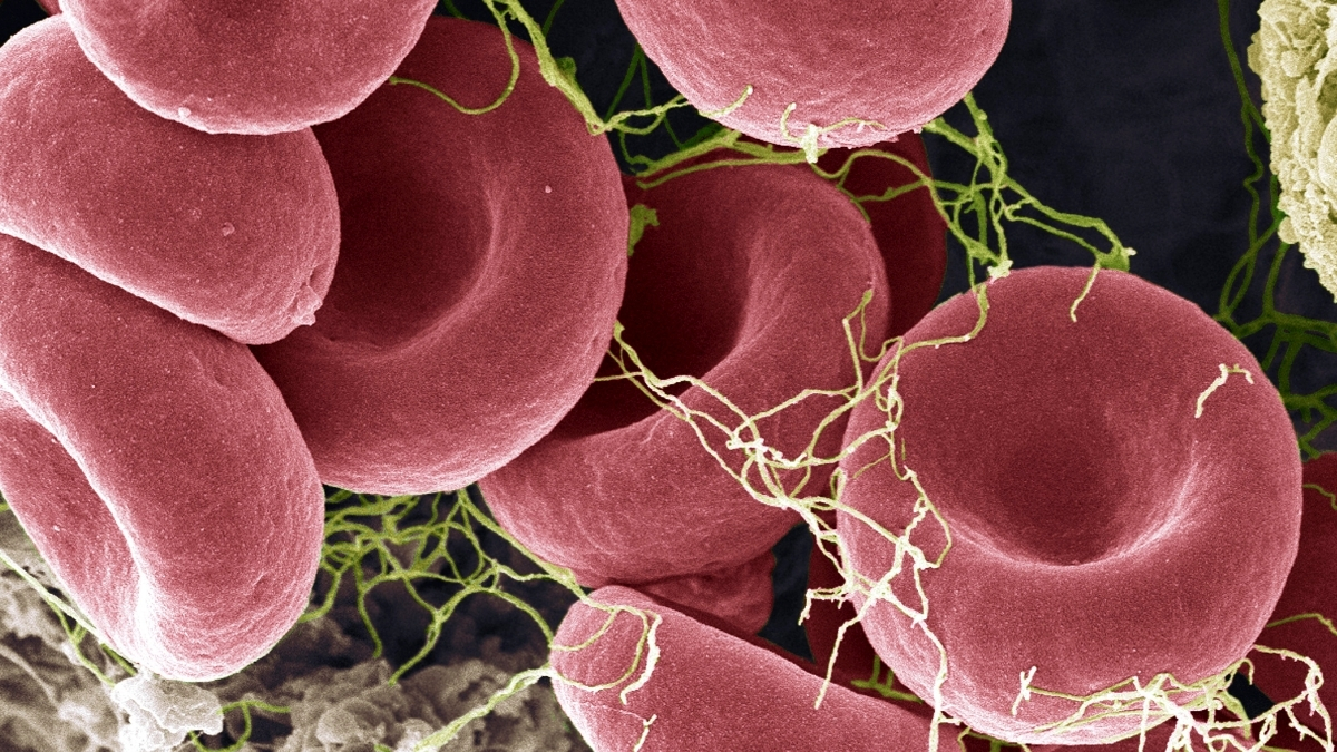 Can a New Blood Test Actually Detect ME/CFS? Here's What We Know : ScienceAlert