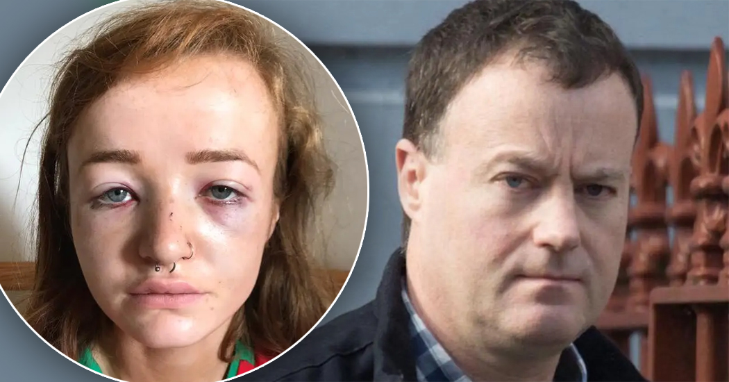 Man charged with serious Letterkenny assault wants to be sentenced 'as soon as possible'