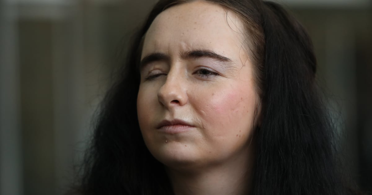 Woman (21) stabbed 50 times by ex-boyfriend says it’s ‘miracle’ she’s alive – The Irish Times