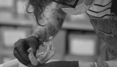 black-and-white image of a person handling a human jaw carefully while gloved
