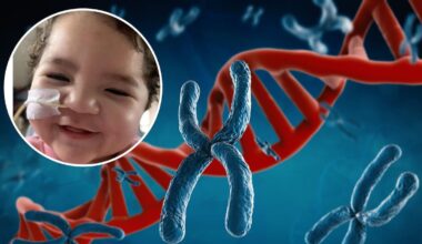 Family fights to keep baby with rare genetic disorder alive