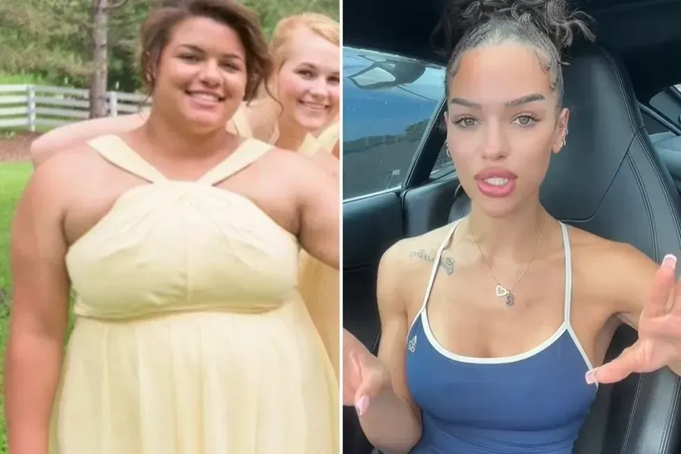 Annabella before and after