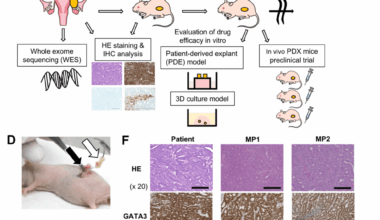 Patient-Derived Xenograft Mouse Model of a Rare Gynecologic Malignancy: Personalized Medicine for the Treatment of Mesonephric-Like Adenocarcinoma
