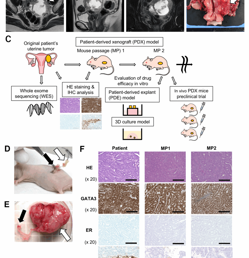 Patient-Derived Xenograft Mouse Model of a Rare Gynecologic Malignancy: Personalized Medicine for the Treatment of Mesonephric-Like Adenocarcinoma