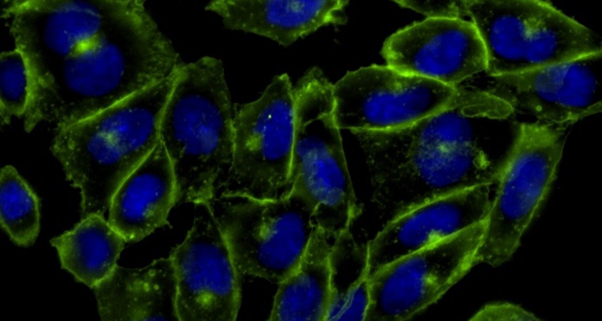a microscope image of fluorescent cells