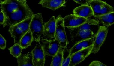 a microscope image of fluorescent cells