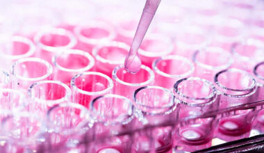 Study links obesity-driven fatty acids to dangerous form of breast cancer – @theU