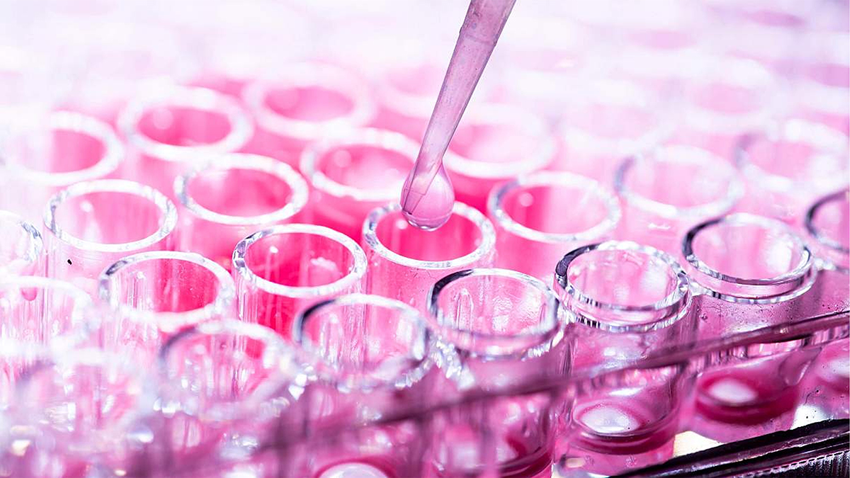 Study links obesity-driven fatty acids to dangerous form of breast cancer – @theU