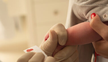 closeup of examining foot in newborn, (foot test)