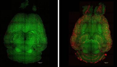 Light sheet fluorescence microscope images of mouse brains 12h after being treated (left) or not (right) with nanoparticles. The brains were analysed to see the amount of Aβ plaques accumulation. Red: Aβ plaques. Green: vessels from the blood brain barrier.