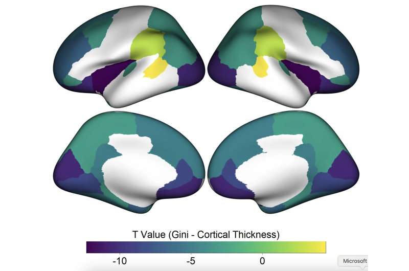 Living in an unequal society impacts the structure of children's brains, study finds