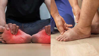 Early symptoms of lung cancer that show up in your legs and feet: Swelling, pain, and colour changes to watch for