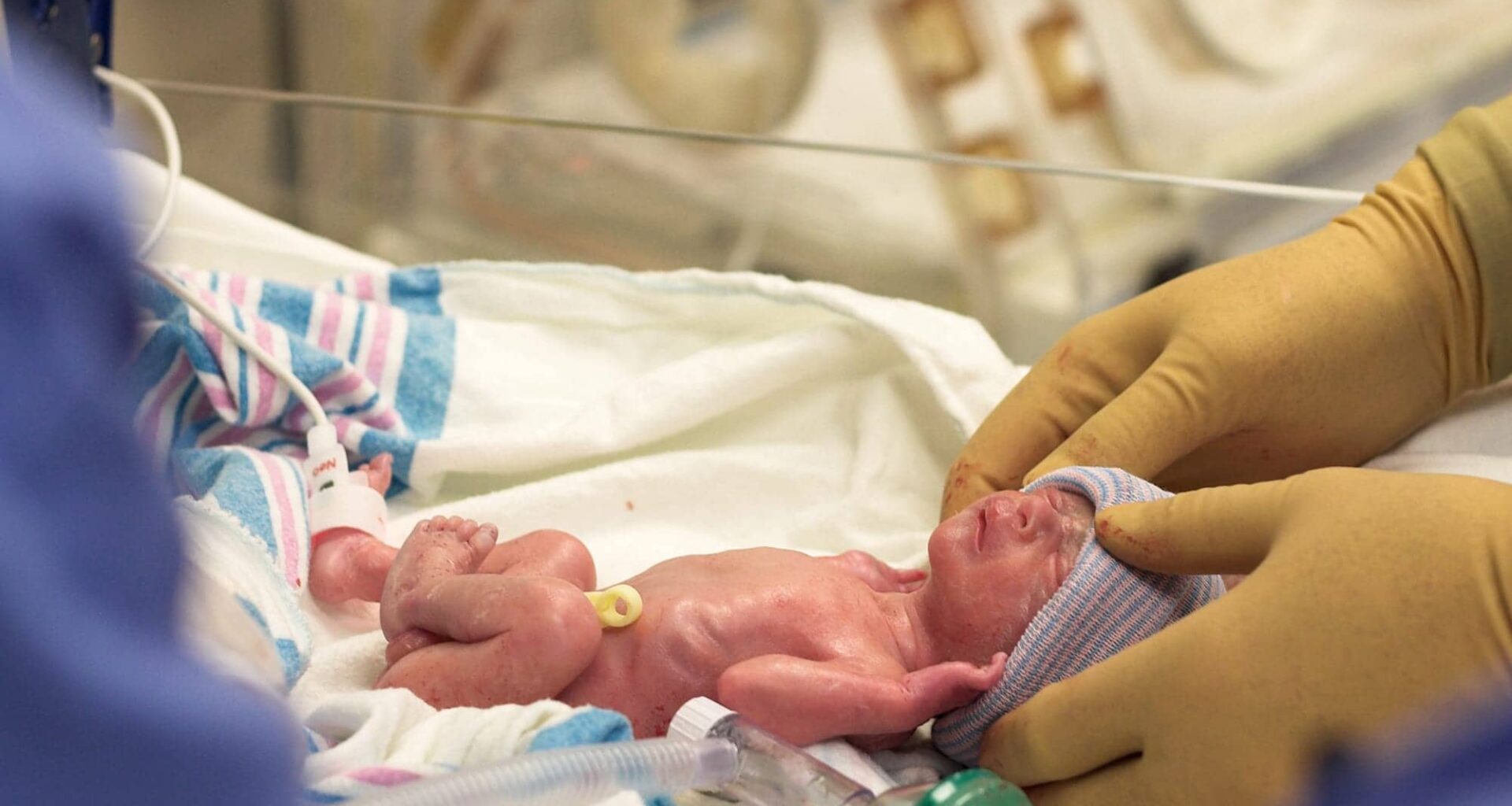 Maternal Childhood Trauma May Increase Preterm Birth Risk