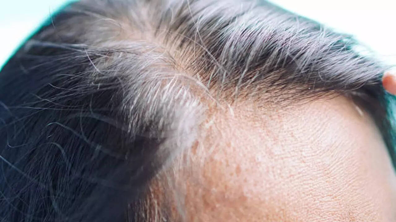 Image credits: Getty Images Stem cell population can follow antagonistic fates