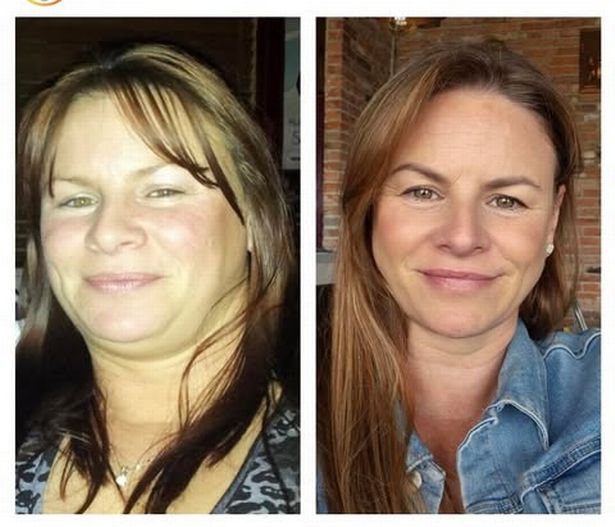 Emma before and after her weight loss journey