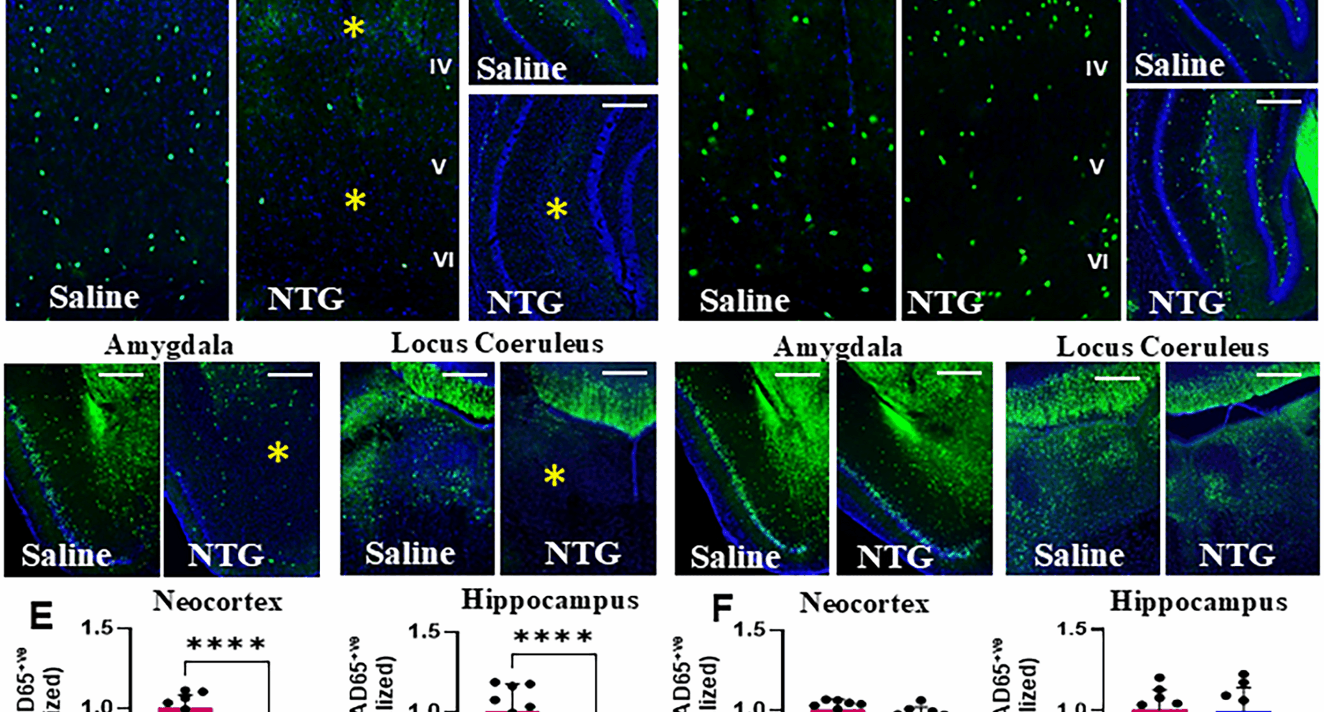 Selective vulnerability of GABAergic neurons in chronic migraine | The Journal of Headache and Pain