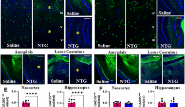 Selective vulnerability of GABAergic neurons in chronic migraine | The Journal of Headache and Pain