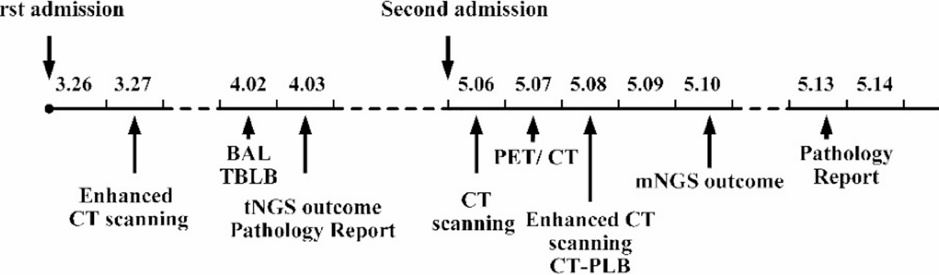 Bilateral pulmonary cavitary mucinous adenocarcinoma in an immunocompetent patient: a case report and literature review | BMC Pulmonary Medicine