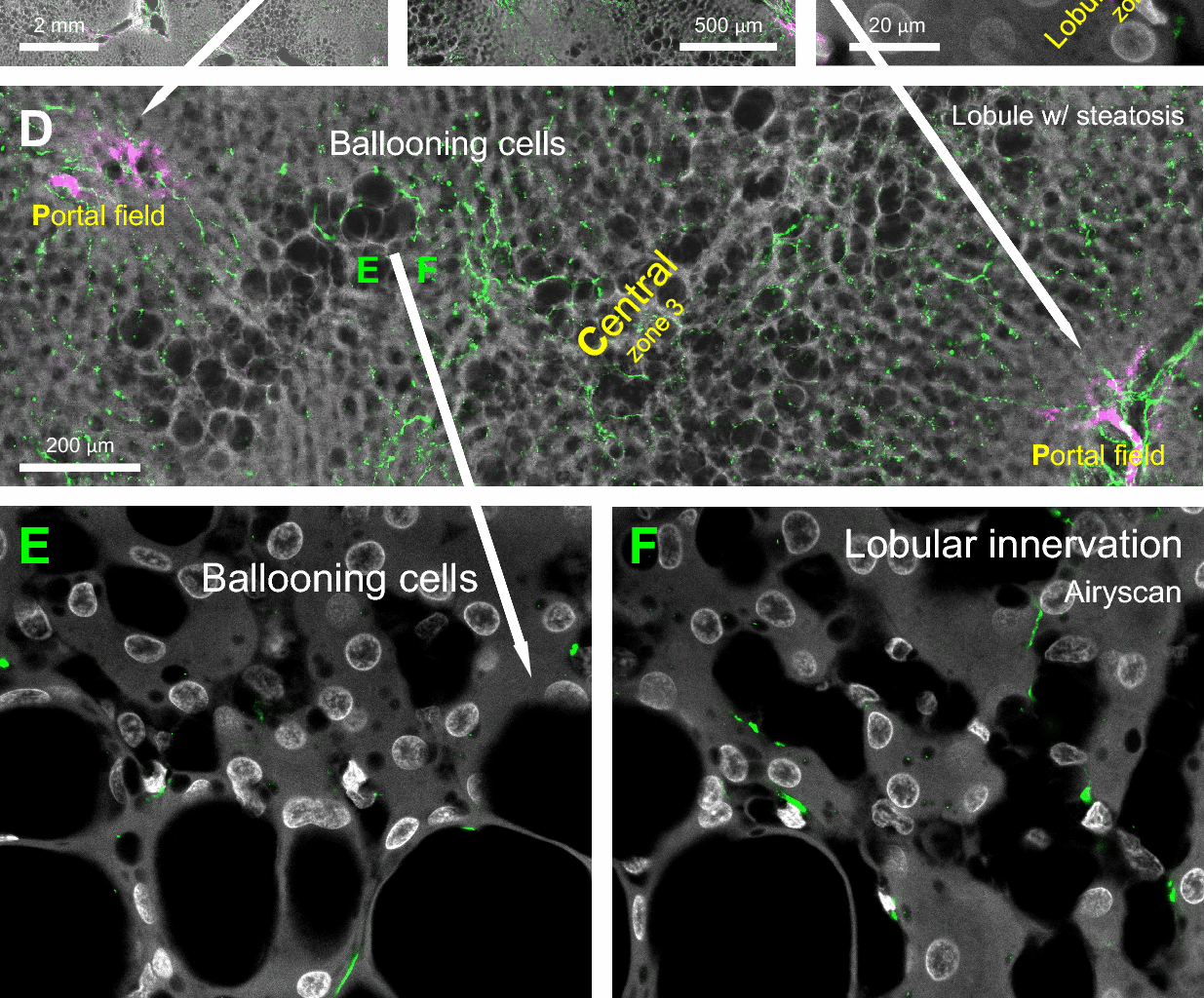 Human liver and pancreas innervation: resolving 3D neurohistological challenges and advancing insights | Journal of Biomedical Science