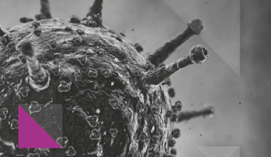 RHOA lactylation at oncogenic hotspots promotes oncogenic activity and protein stabilization | Molecular Cancer