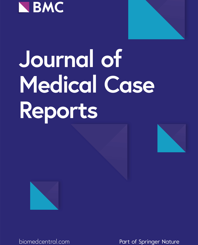 Complex dissociation following maternal suicide attempt in a 17-year-old female: a case report | Journal of Medical Case Reports