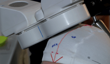 FDA approves new device for teens with severe depression