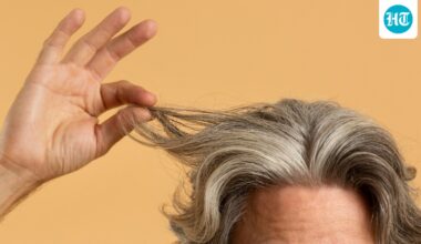 Grey hair might reflect a hidden defence that clears damaged cells and lowers melanoma risk, says study
