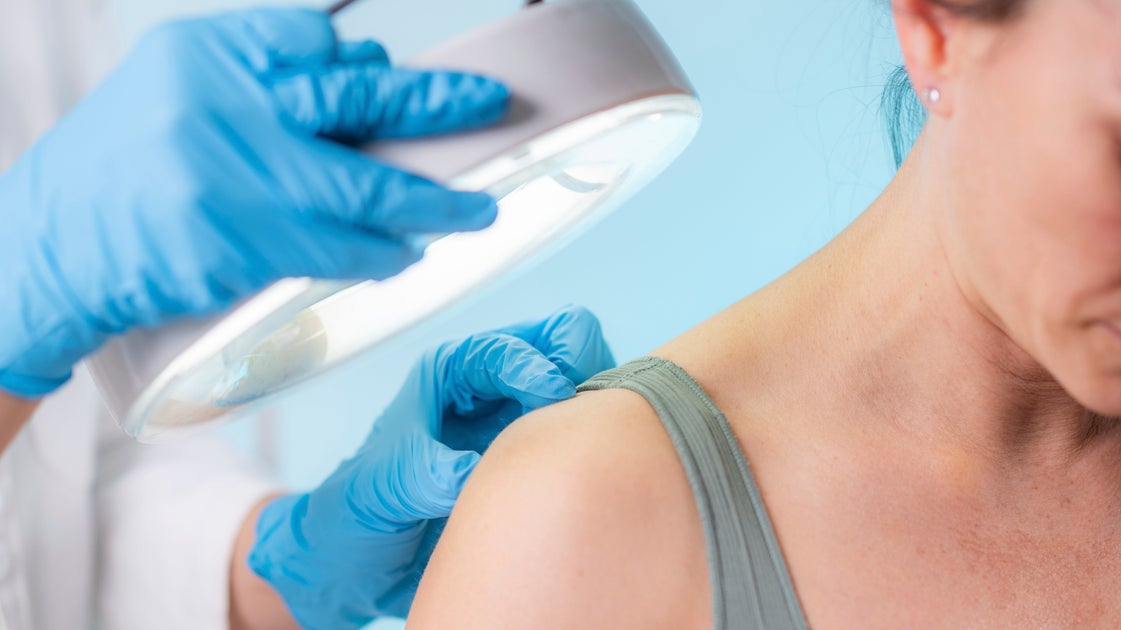 The Signs Of Stress In Your Skin