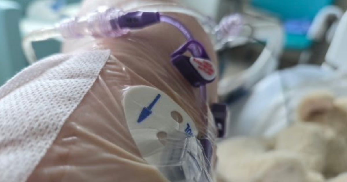 Canadian seniors struggle to recover post-surgery: study