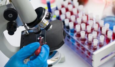 Ireland had second-highest rate of HIV diagnoses in EU last year, amid concern over late detection