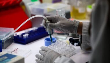 Bird flu could cause pandemic worse than COVID if virus mutates: Institut Pasteur