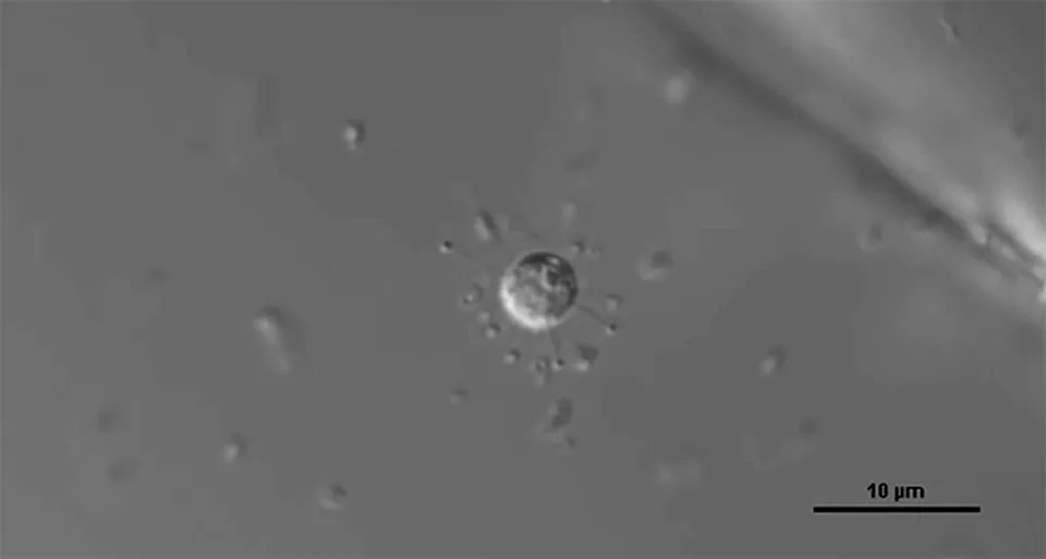 <strong>TINY HUNTER:</strong> Microscopic view of S. arienae displaying celestiosome protusions used to capture bacterial prey. <em>Image from Valt, M., </em>et al. Nature <em>(2025).</em>