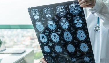 People suffering from Parkinson’s disease feel pitied and misjudged, Irish study finds