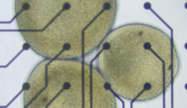 Brain organoid scientists worried by push into biocomputing