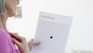 Inflammation control can protect against AMD-like retinal damage