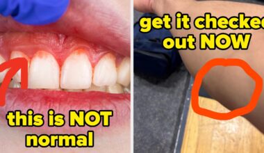 19 Doctors Share Health Signs You Shouldn't Ignore